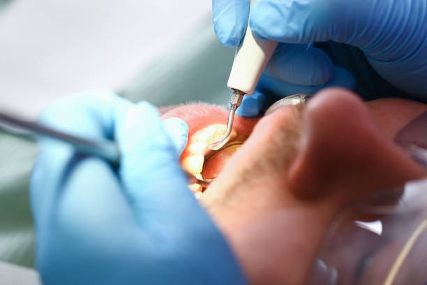 Best Emergency Dental Care for Broken or Chipped Teeth in Countryside, IL