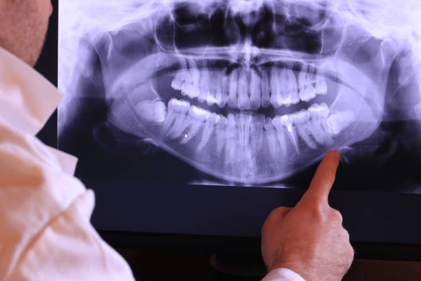 Best Emergency Tooth Extraction in Countryside, IL